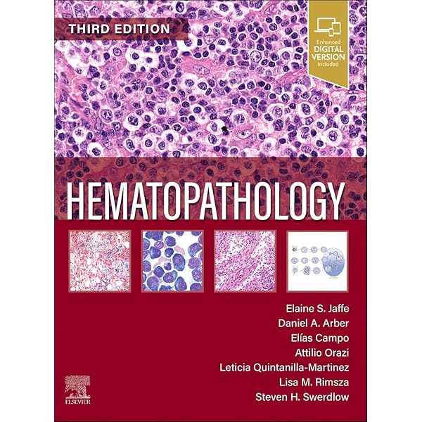 WHO Classification of Tumours of Haematopoietic and Lymphoid